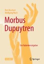 Morbus Dupuytren - Ein Patientenratgeber